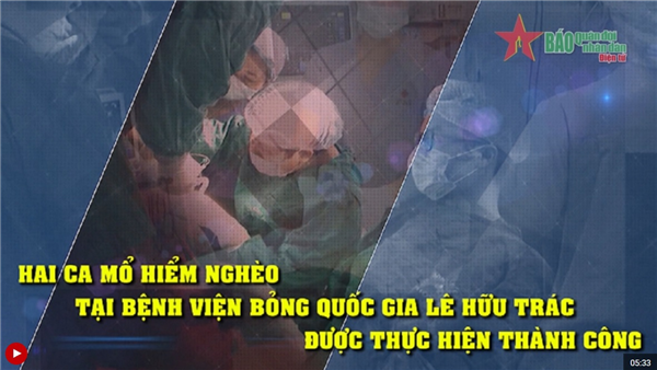 Hai ca mổ hiểm nghèo tại Bệnh viện Bỏng Quốc gia Lê Hữu Trác được thực hiện thành công